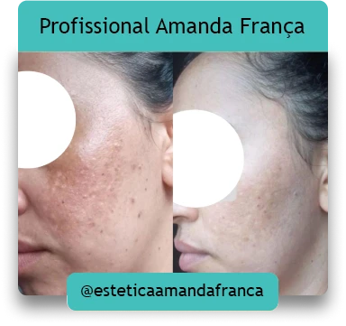Online Amanda Destravar