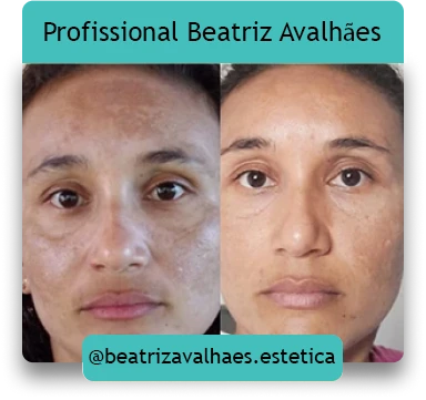 Online Beatriz Destravar