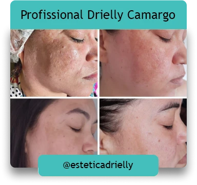 Online Drielly Destravar